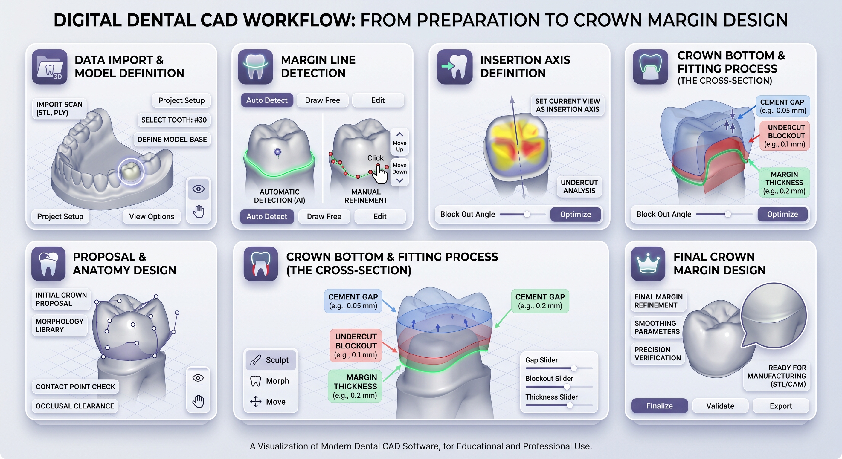 Step by step dental CAD margin design workflow from scan to final crown